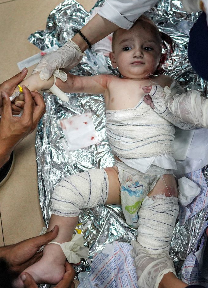 Verletztes Baby aus Gaza